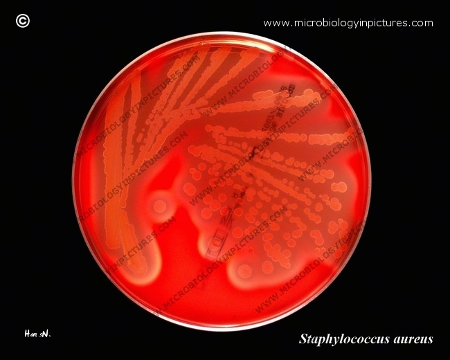 s.aureus and hemolysis